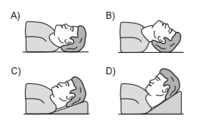 Baş-çene pozisyonları - Suni solunum için hava yolu açma | testçöz.com