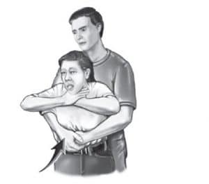 Heimlich manevrası uygulaması - Solunum yolu tıkanıklığında ilk yardım | testçöz.com