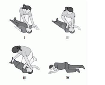Koma pozisyonu verme aşamaları (4 adım) - Ehliyet ilk yardım konu anlatımı | testçöz.com